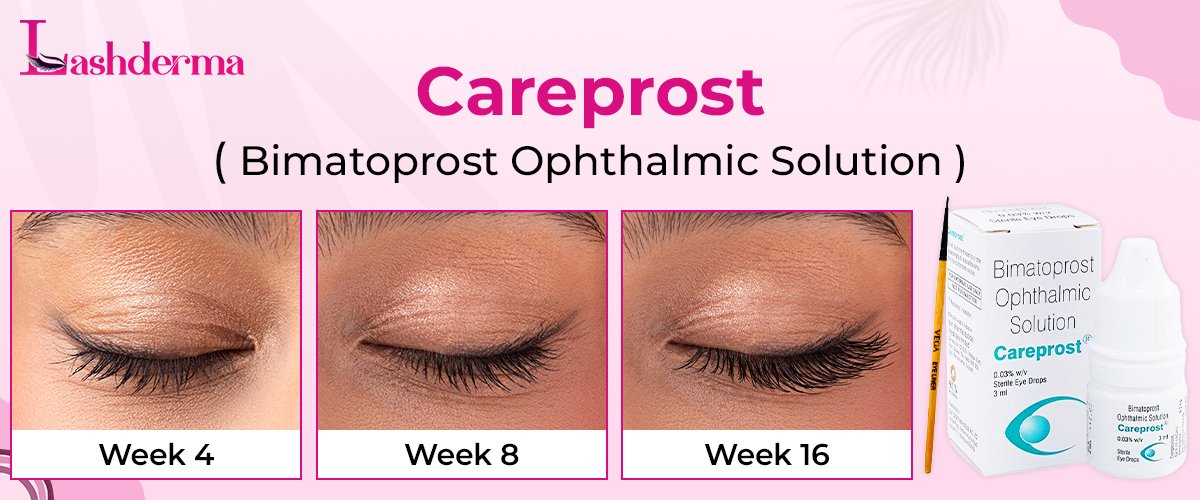 Careprost 4 careprost week result before after